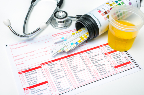 Check-up, Medical report and urine test strips